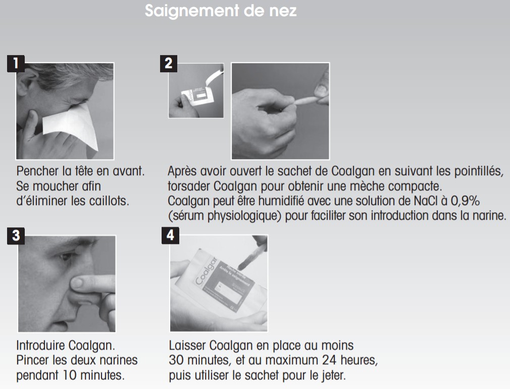 Coalgan : mèche hémostatique  Saignement de nez, cutané, bouche